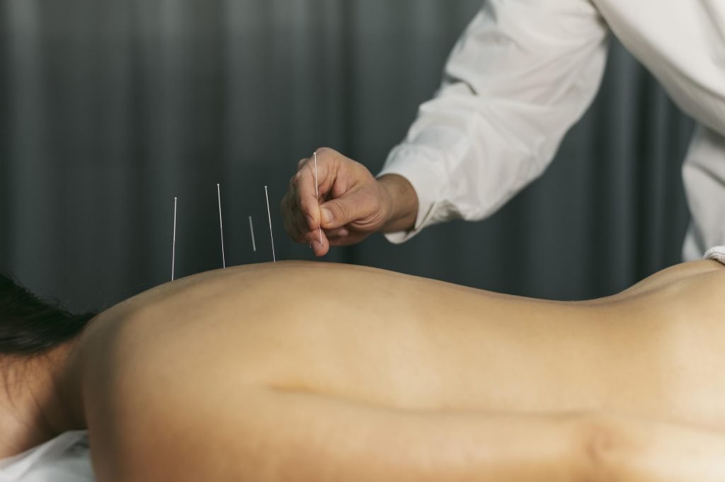 Acupuncturist in Haarlemmermeer