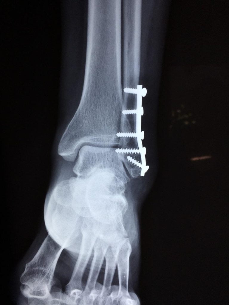 Orthopedie in Haarlemmermeer